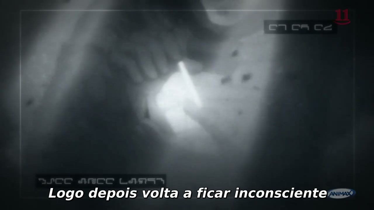 Episódio 004