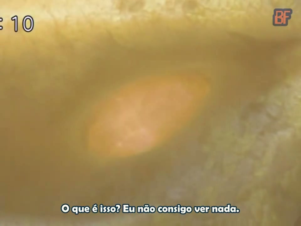 Episódio 007