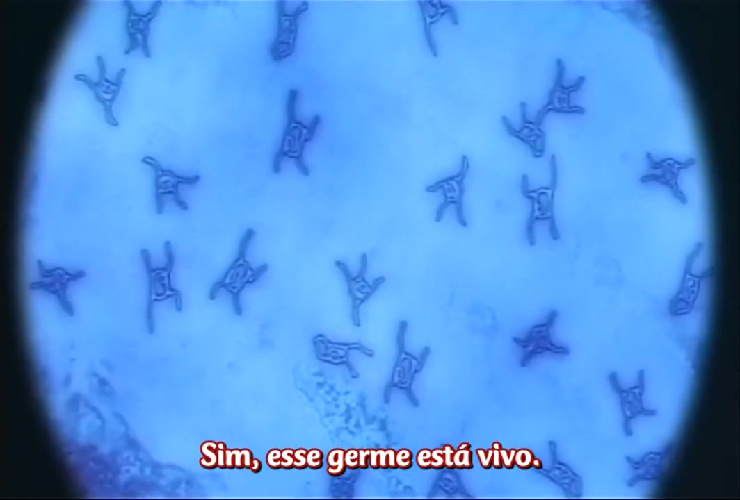 Episódio 034