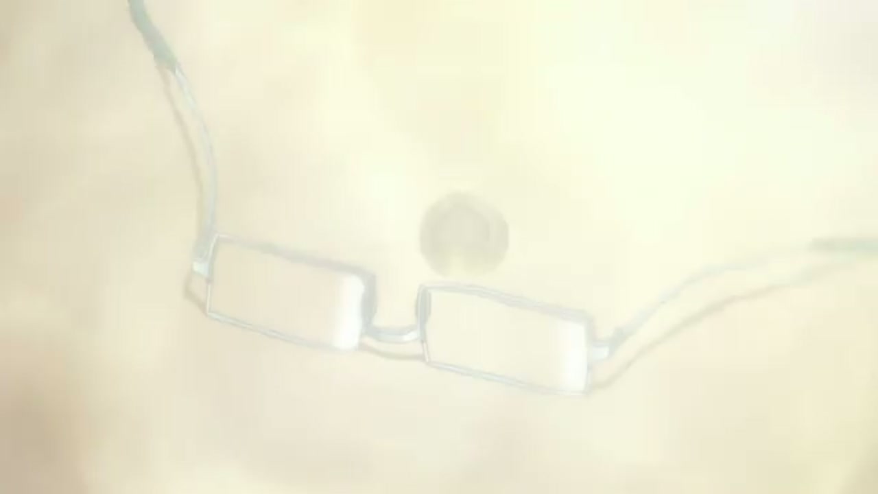 Episódio 003