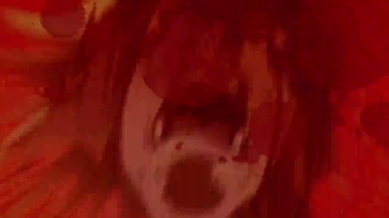Episódio 003